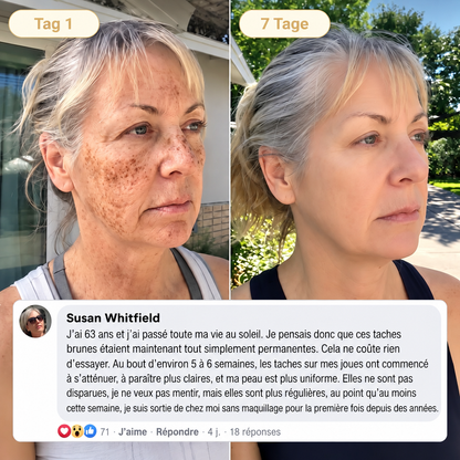 ⏰ Offre exclusive 𝐇𝐢𝐬𝐤𝐢𝐧® débloquée ! Aujourd’hui seulement : économisez 50 % supplémentaires — obtenez votre soin de nuit avant la fin de cette offre ! ✅