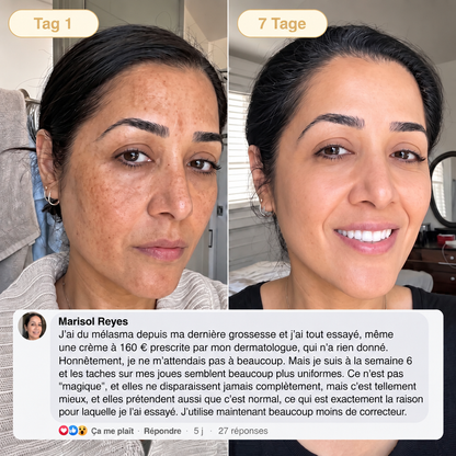 ⏰ Offre exclusive 𝐇𝐢𝐬𝐤𝐢𝐧® débloquée ! Aujourd’hui seulement : économisez 50 % supplémentaires — obtenez votre soin de nuit avant la fin de cette offre ! ✅
