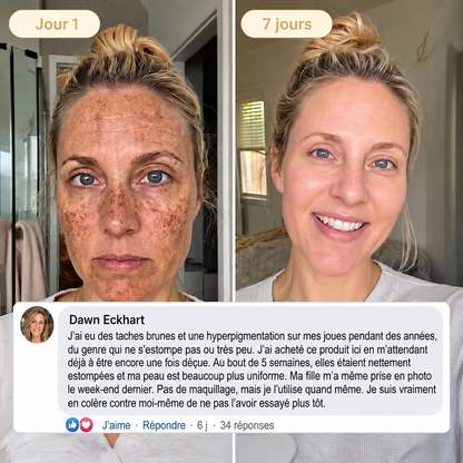 ⏰ Offre exclusive 𝐇𝐢𝐬𝐤𝐢𝐧® débloquée ! Aujourd’hui seulement : économisez 50 % supplémentaires — obtenez votre soin de nuit avant la fin de cette offre ! ✅