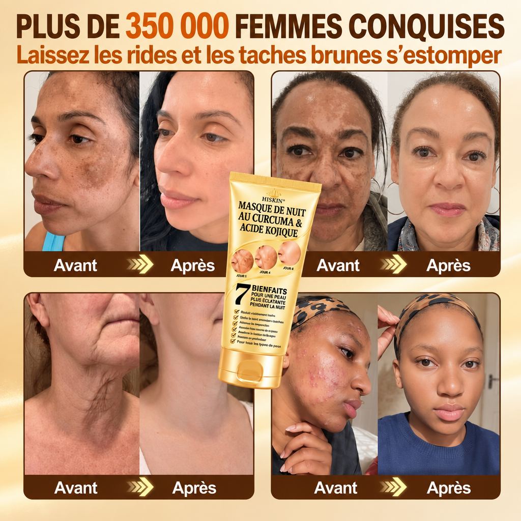 𝑶𝒇𝒇𝒊𝒛𝒊𝒆𝒍𝒍𝒆𝒓 𝑺𝒉𝒐𝒑 | ✨ 𝐇𝐢𝐬𝐤𝐢𝐧® Kurkuma × Kojisäure Overnight Peel-Off-Maske — Gegen Pigmentflecken & sichtbare Falten 🌙✨