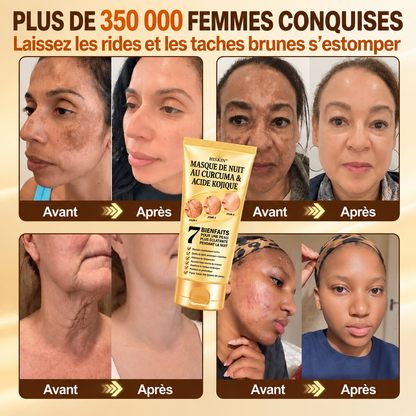 𝑶𝒇𝒇𝒊𝒛𝒊𝒆𝒍𝒍𝒆𝒓 𝑺𝒉𝒐𝒑 | ✨ 𝐇𝐢𝐬𝐤𝐢𝐧® Kurkuma × Kojisäure Overnight Peel-Off-Maske — Gegen Pigmentflecken & sichtbare Falten 🌙✨